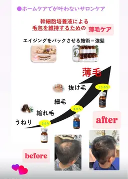 強髪メニュー(髪を増やしていく1回目価格)濃度20%