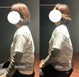 【トータルケア】美容鍼×整体プレミアム★90分¥15,000→¥10,000