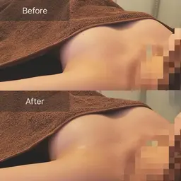 人気No.3⭐️痩せたい・足を細くしたい・くびれを作りたい・全身ケアしたい方⭐️全身悩み改善しつつバストケア