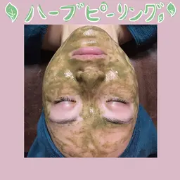 【minimo限定！毛穴の黒ずみ・ニキビ・くすみにオススメ¥15,000→¥10,000】陶器肌ハーブピーリング