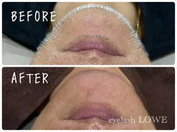 【光り輝くツヤ肌✨】メンズフェイシャルワックス（全顔）👩✨古い角質や産毛を除去してツルスベお肌に🫧