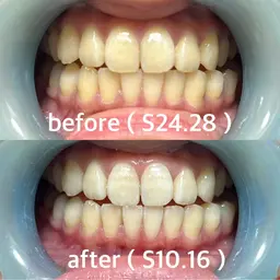 【結果重視】20歳限定！