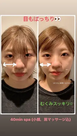 【頭も顔もスッキリ⭐】リラクゼーション炭酸 20minヘッドスパ+コラーゲンパック+ケアプロ超音波アイロン