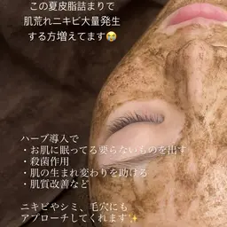 【minimo限定🩷】ハーブピーリング🍃ニキビやニキビ跡・毛穴にも⭕️