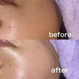 内側から発光するお肌へ~フェイシャルワックス~