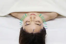 美容鍼灸60本+テラヘルツ細胞美容