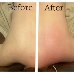 日頃のお疲れに✨肩首スッキリ✨脚のむくみにも！！【全身深圧スポーツアロマ60分】ミニモ限定🌿特別価格🌿