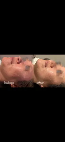 【✨フェイシャルエステ✨】