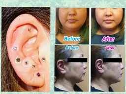 【本日限定メニュー】効果抜群♪すぐ体感♪耳リンパほくじ★耳つぼジュエリー各3ヶ付き