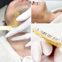 銀座・メンズ5000円【ヒゲワックス脱毛】首、頬、鼻下、口下 4カ所セット