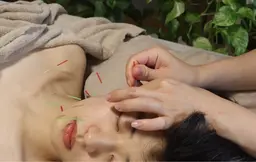 回数券コース🎫✨リフトアップ美容鍼60分3回券👉¥27,800(こちらのコースは頸・デコルテオイル付きです)