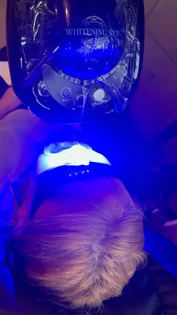 ホワイトニング