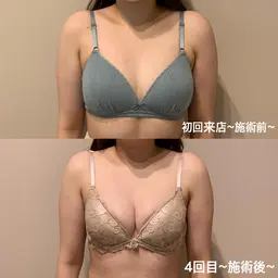 【背面含むバストケアで全身整うひと時】お背中と足元からのケアで根本改善を目指します！最新機器で驚きの効果と筋膜リリース♪