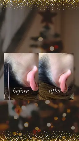 【後ろ姿美人✨】スッキリ綺麗に！うなじ、もみあげWax脱毛（＋保湿付）