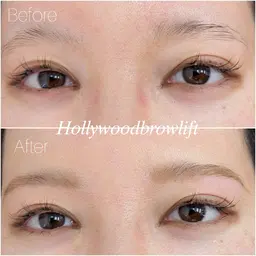 【リピート2回目】HBL