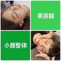 【 美容鍼 ＋ 小顔整体 】（目元スッキリ、お顔のむくみスッキリ） 60分 ￥5,500→￥5,000