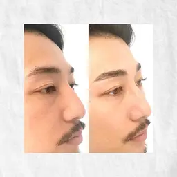 無料🌟メンズアイブロウスタイリング/ワックス脱毛&毛量調整