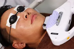 ヒゲ脱毛体験✨