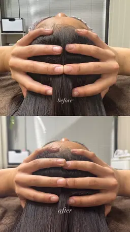 【究極小顔コース⭐︎】3step小顔➕頭蓋骨矯正付き(100min)¥24,200→¥4,950