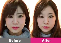 【初回割引キャンペーン⭐️今月残り2名❗️】小顔矯正＋全身整体が割引価格でご体験頂けます✨❣️