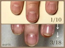 【オフあり】自爪育成クリアネイル：自爪育成ケア込み、フィルイン対応、スカルプ パーツオフ別途220円