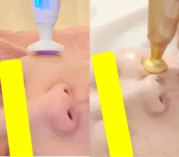 ❣️ミニモ特別価格❣️【2in1プラズマ】肌質改善&リフレッシュうる艶もち肌70分