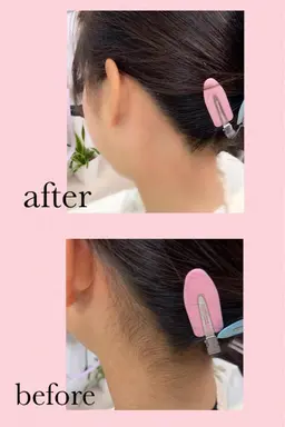 🍐うなじWax脱毛🍑気になるムダ毛無くしませんか❓ レディース&メンズ◇60分～90分