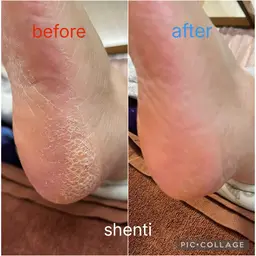 保湿パック付き・足裏(かかと)角質除去ケア