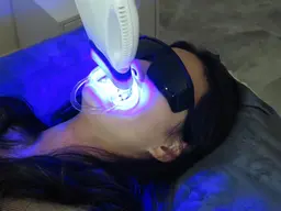 【ミニモ限定】セルフホワイトニング🦷8分×2回　🩷女性も男性も歓迎🩷