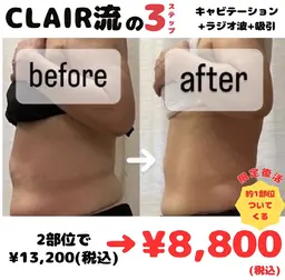 【脂肪撃退!】痩身3ステップ60分かけ放題¥8,800!