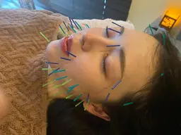 【体験】💄感動小顔:美容鍼💄　　　　　　　　　　　　　　　　　　　　　　初めての方はまずはこちらのコースで体験を⭐️