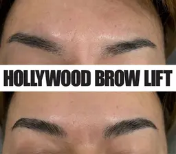 ハリウッドブロウリフト