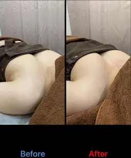 【バストケア部門　全国1位受賞】バストアップ(バストトップアップ・ハリアップ) 光豊胸　1回　お試し