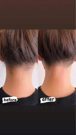 シュガーリングワックス🍯うなじ脱毛