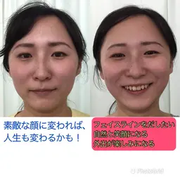 【小顔整体モデル募集】顔出要  男女OK!   笑顔が似合う顔になろう！　眼精疲労　脳疲労　首こり　肩こり　にも対応