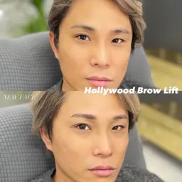 【メンズモデル価格】ハリウッドブロウリフト