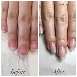 自爪育成🌼オフケア込み　¥9,000​〜​