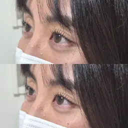 ラッシュリフト【コーティング付】