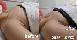 ナリス Cavi3sPRO バストケア