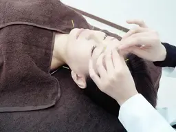 やさしい美容鍼コース初回キャンペーン