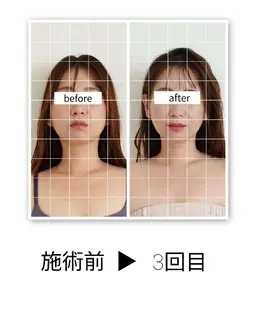 小顔矯正×フットケア(骨盤ケア) 【顔のたるみ、食いしばり、足のむくみが気になる方に】