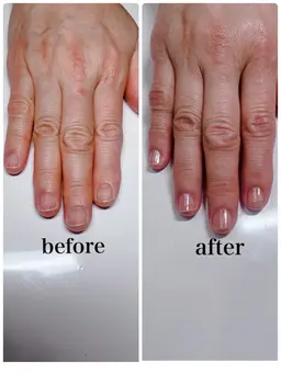 先着5名様お試し⭐︎最強のネイルケア90分(初回限定)