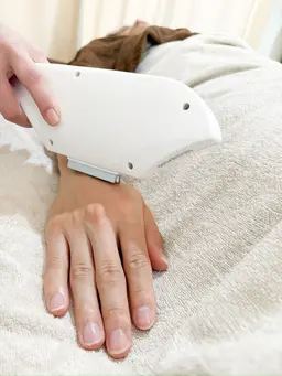 腕と手の甲セット脱毛