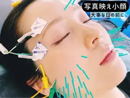 【写真映え小顔】むくみ×EMSリフト美容鍼60分