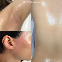 新生活応援🌸【背中ALL+1箇所(もみあげor脇)】