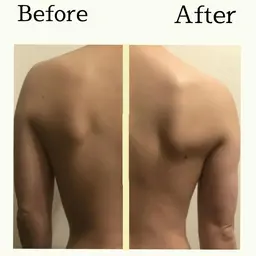 【抜けない疲労に一度でアプローチ✨】脳リラックスメソッド80分🌟肩こり、肩甲骨、むくみ、スマホ首、二の腕🌟