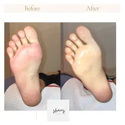 【ゴッソリ取れる角質ケア♥】部位別撮影ありです📷