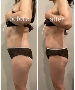 計120分　［ストレスフルな方へ］腸タイプカウンセリング30分＋オーダーメイド腸もみ90分