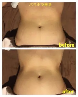 初回2パーツまで半額　パラボラ痩身