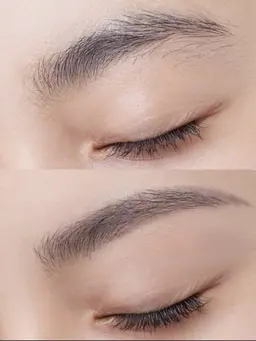 ハリウッドブロウリフト